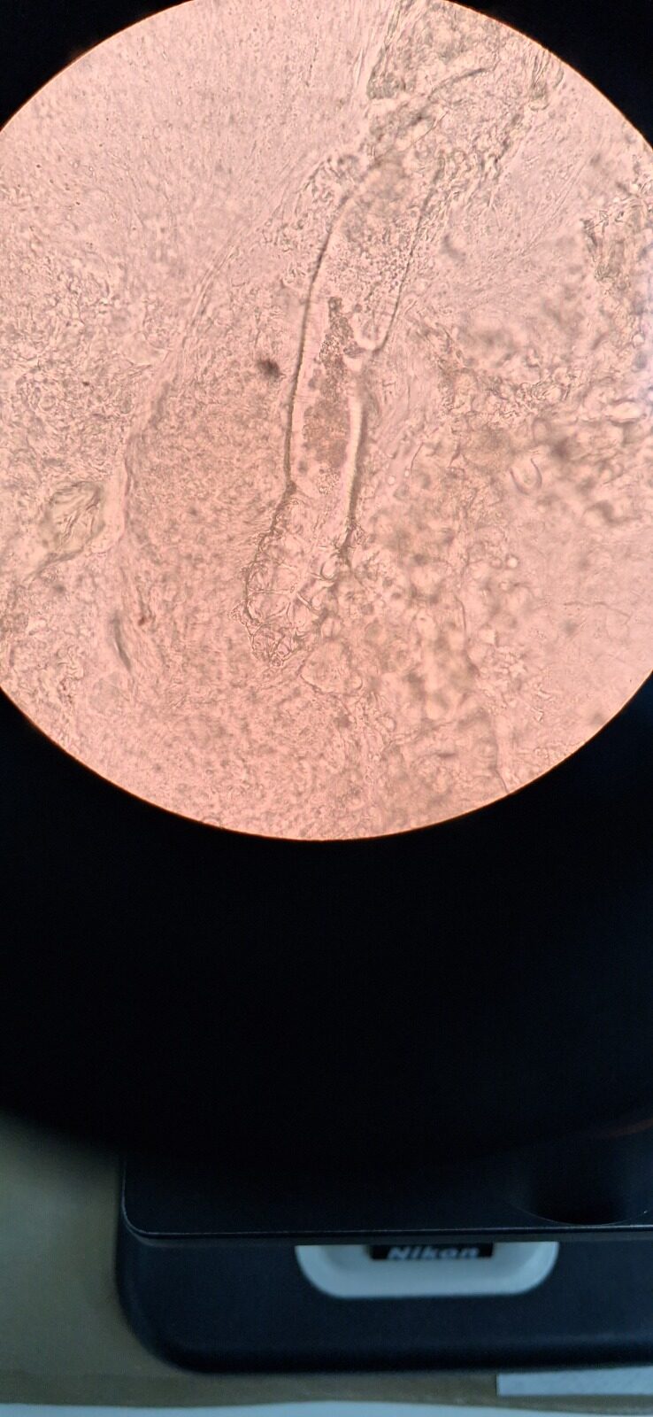 Caso clínico de Demodex