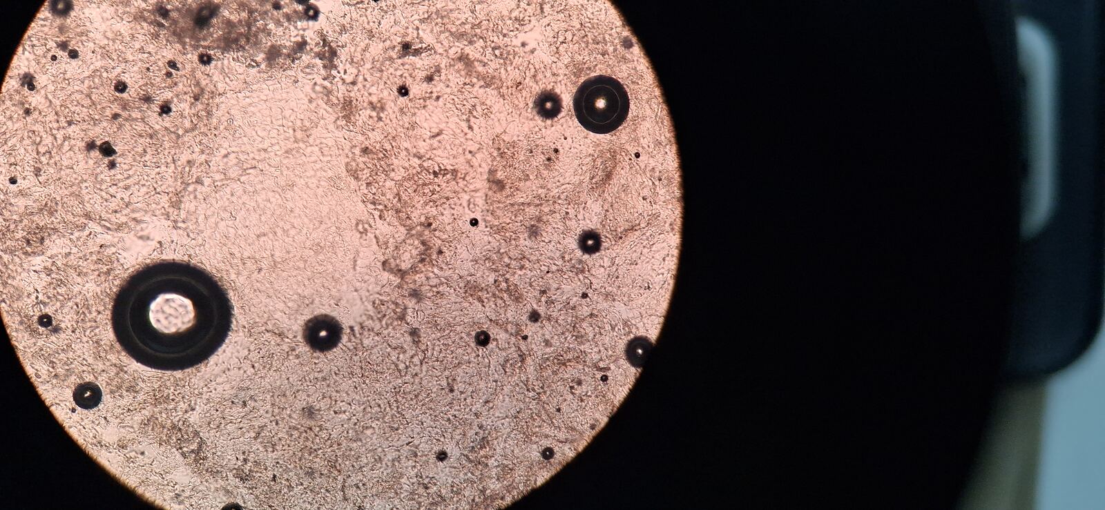 Disqueratosis: imagen antes