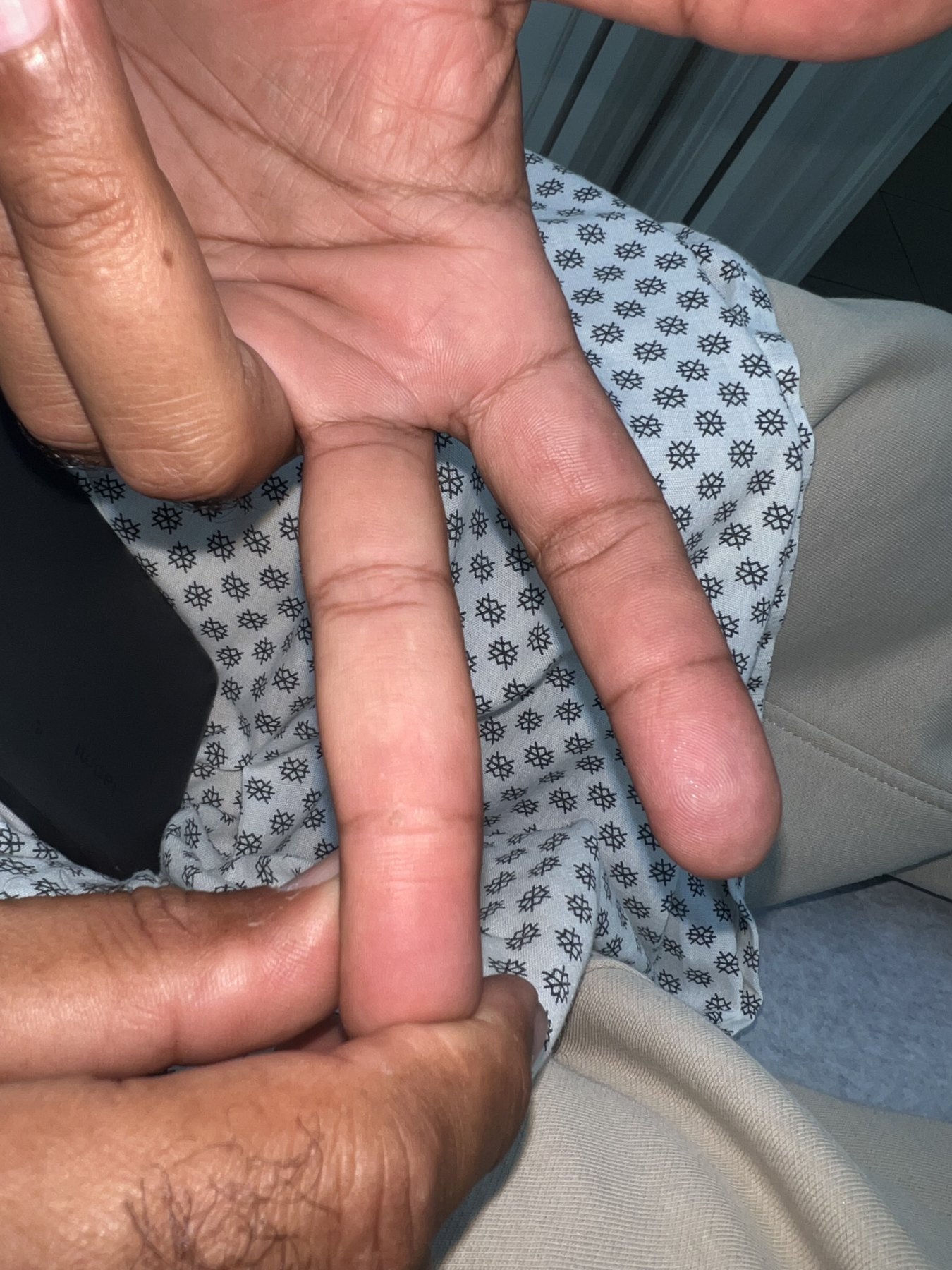 Fibroqueratoma vs verruga: imagen después