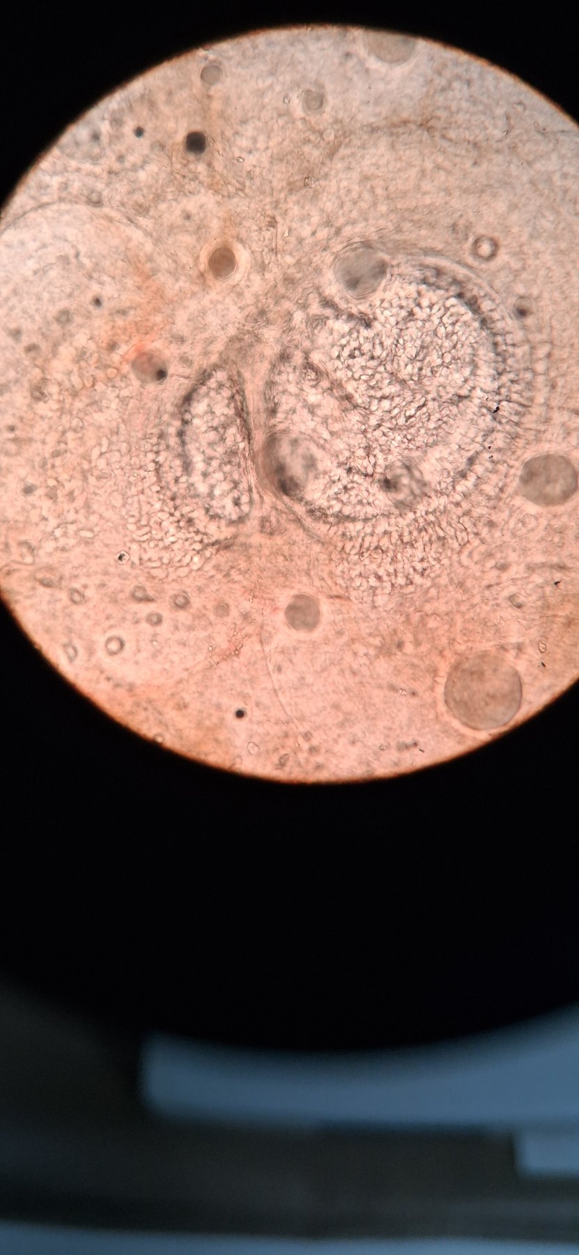Molusco contagioso: imagen antes
