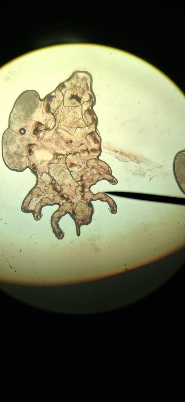 Pediculosis: imagen después