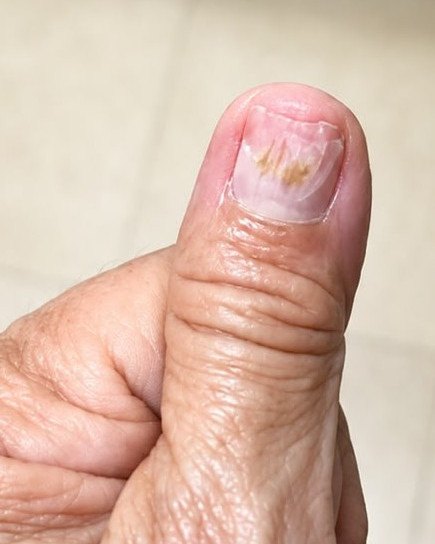 Pseudomonas: imagen después